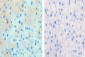 CPT1A Antibody (C-term)